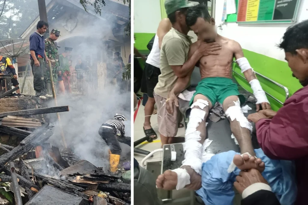 satu orang alami luka bakar akibat kebakaran