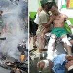 satu orang alami luka bakar akibat kebakaran